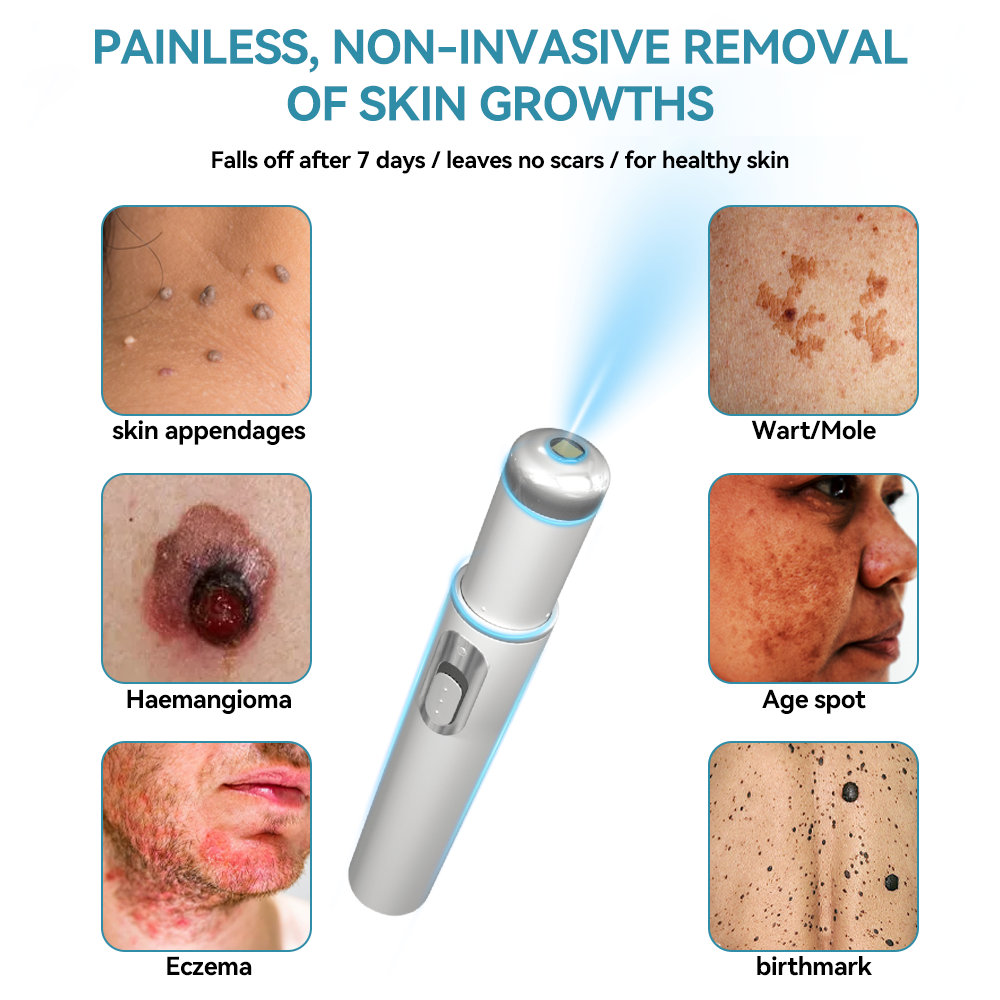๐๐๐ฌ๐ฌ๐๐๐ฆยฎ Medical-Grade Laser Pen ๐ (Powered by COโ laser technology โ effectively removes moles, warts, skin tags, pigmentation marks, and other skin imperfections)๐
