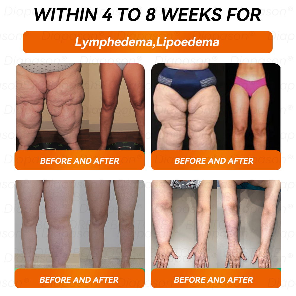 ๐ท๐๐๐๐๐ ๐๐ยฎ ๐๐ด๐ท+ ๐บ๐ฟ๐-1 Slimming Drops ๐ง - Suitable for Obesity, Diabetes, and Cardiovascular Conditions