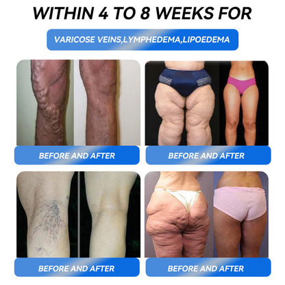 𝐈𝐅𝐌𝐀𝐆𝐈𝐂® 𝐆𝐋𝐏-𝟏 𝐏𝐫𝐨 𝐖𝐞𝐢𝐠𝐡𝐭 𝐋𝐨𝐬𝐬 𝐎𝐫𝐚𝐥 𝐒𝐨𝐥𝐮𝐭𝐢𝐨𝐧🏆